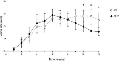 The impact of cholesteryl ester transfer protein on the progression of cutaneous leishmaniasis